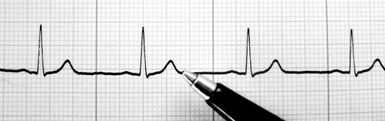 Gauging Project Health Using Online Task Tracking Software, Intervals